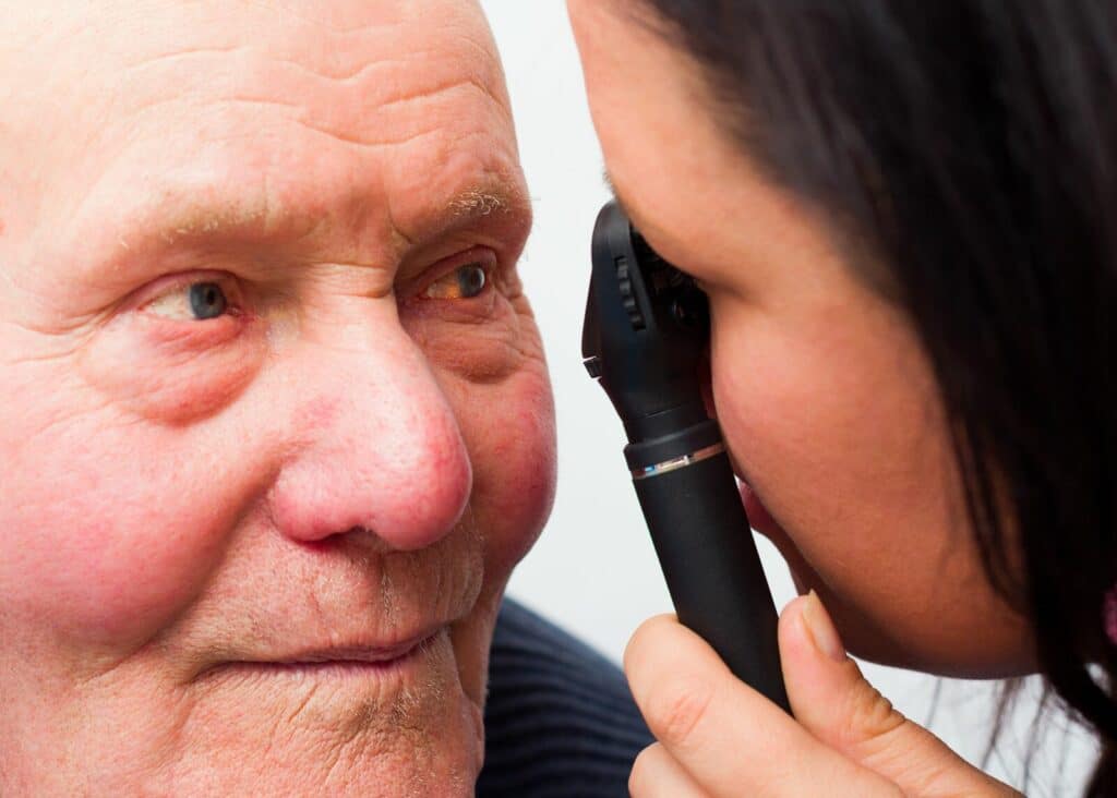 Home Care Services in Springfield PA: Senior Dry Eyes